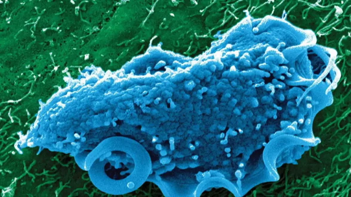 Эта группа причудливых микроорганизмов, обитающих в кишечнике, оказалась неожиданно сложной