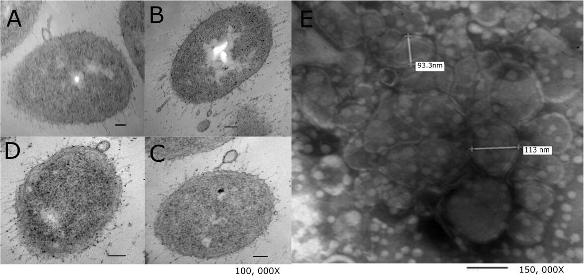 Исследователи разрабатывают потенциальную вакцину против антибиотикорезистентных энтерококков