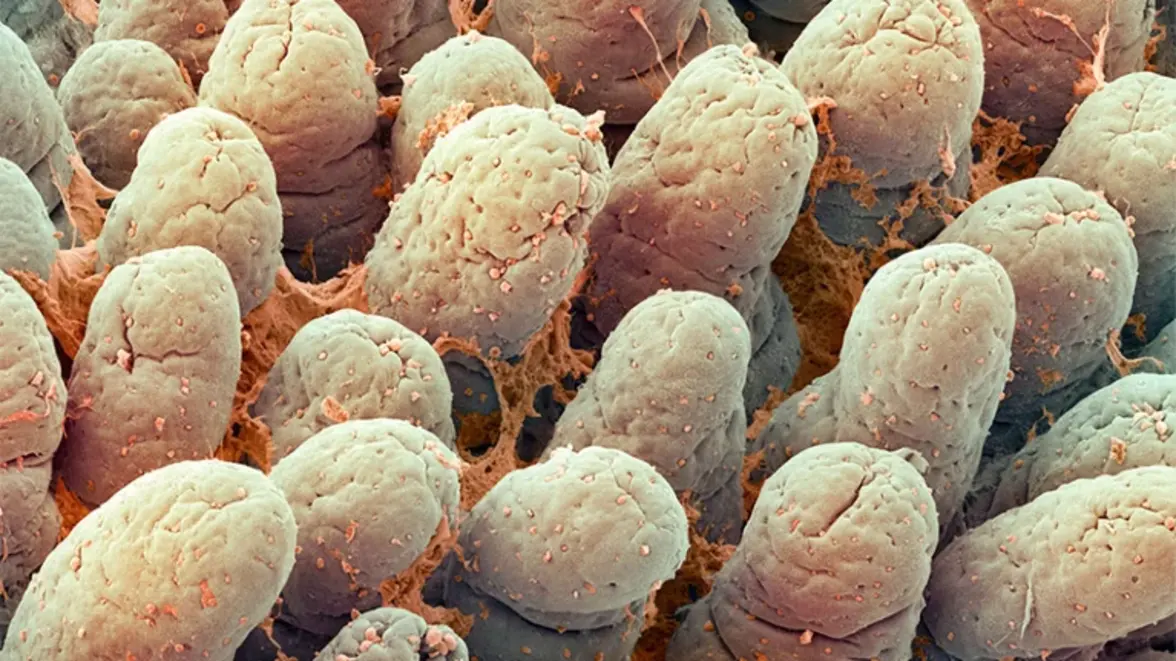 Появились новые факты о том как хронический стресс вредит кишечнику