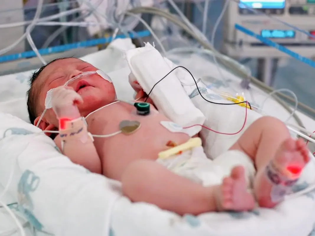 Диагностические критерии педиатрического сепсиса обновлены в США впервые с 2005 года