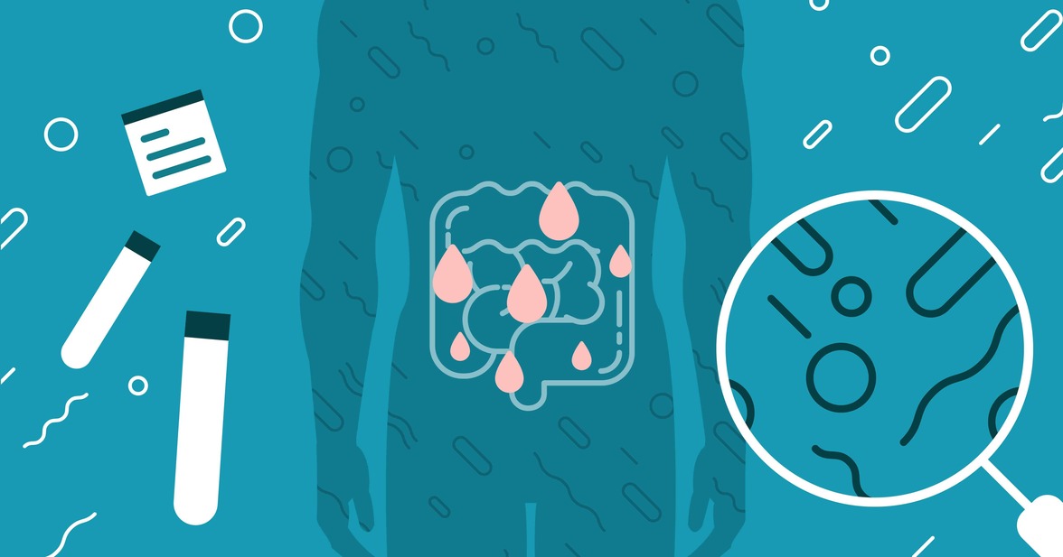 Диагностическое управление помогает снизить уровень заболеваемости C. difficile в педиатрическом стационаре