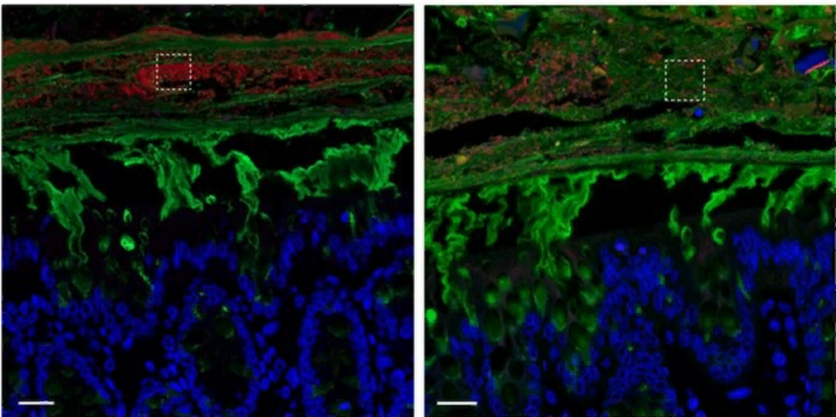 Почему слизь и мокрота имеют значение в здоровье и заболеваниях
