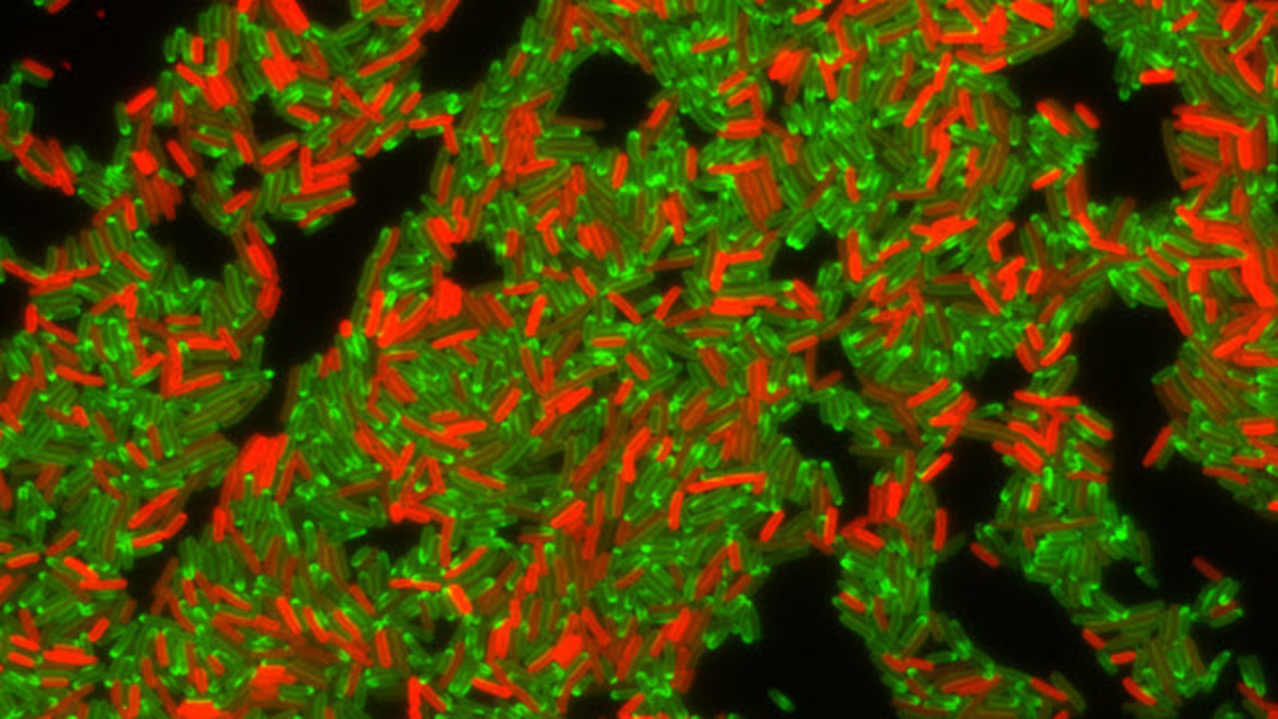 Кто есть кто среди бактерий: надежный метод таксономии видов и штаммов