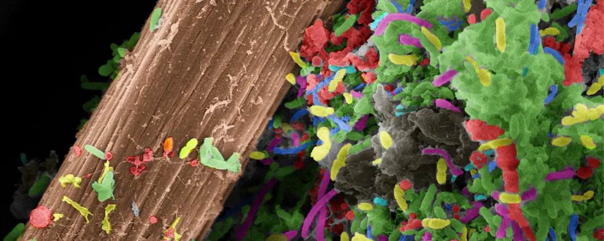 Электрические бактерии: некогда малоизвестные микробы вдохновляют на создание нового поколения "живой электроники"