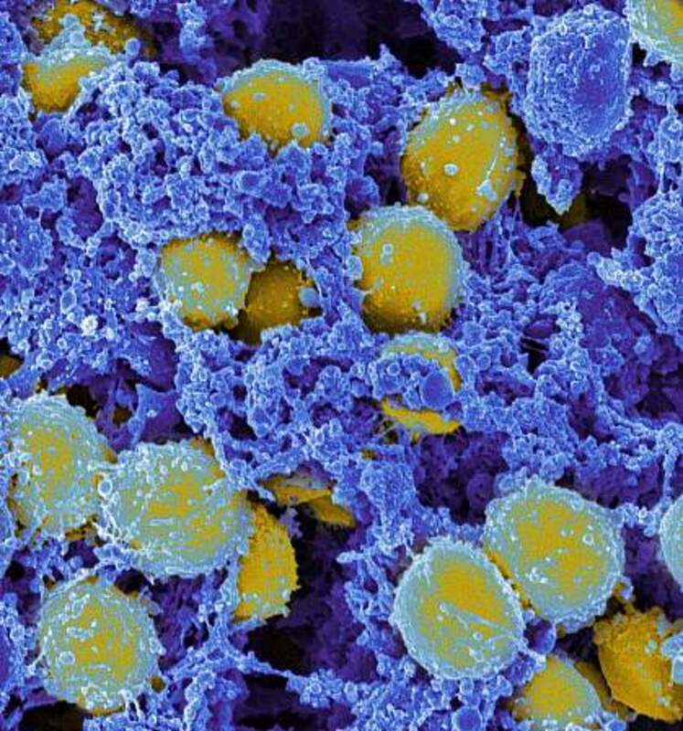 Колонизация Staphylococcus aureus и методы его деколонизации