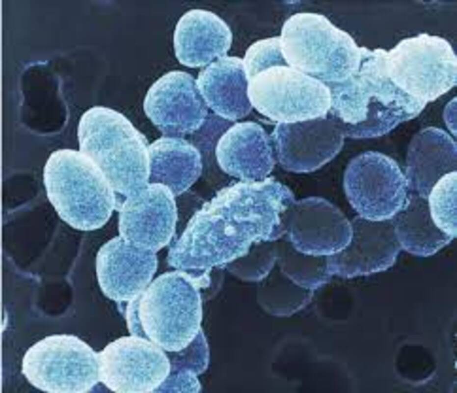 Ruminococcus bromii, микроб, который любит углеводы