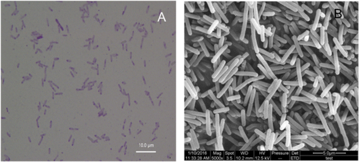 Clostridium butyricum - бактерия, которая помогает нам чувствовать себя наилучшим образом
