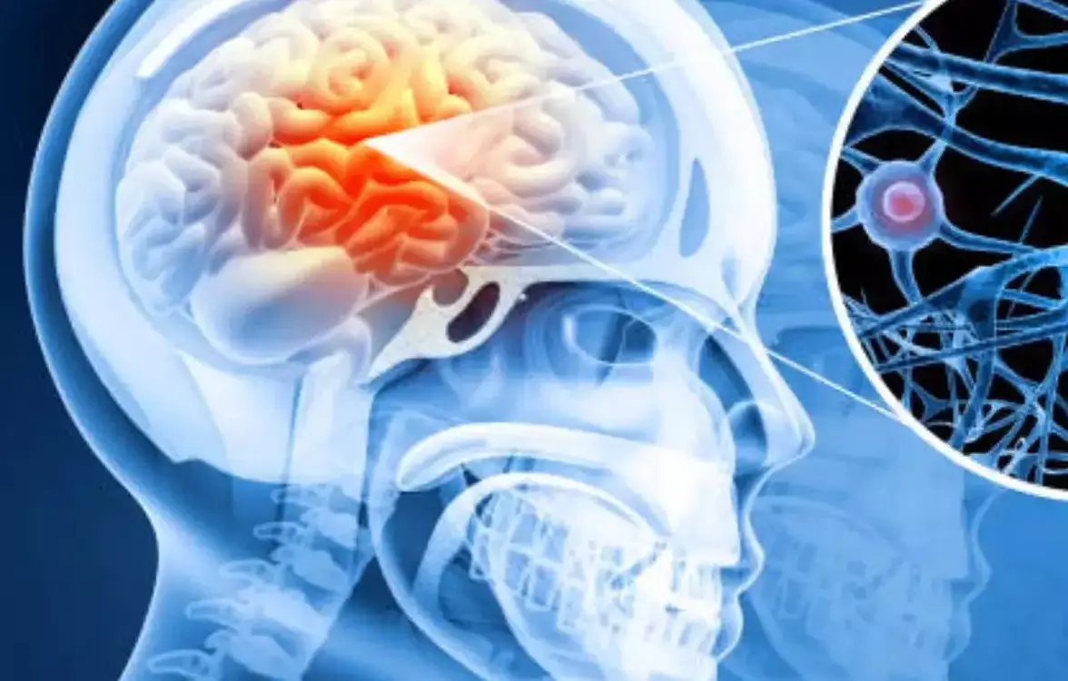 Новое понимание механизмов бактериальной инвазии в мозг при менингите