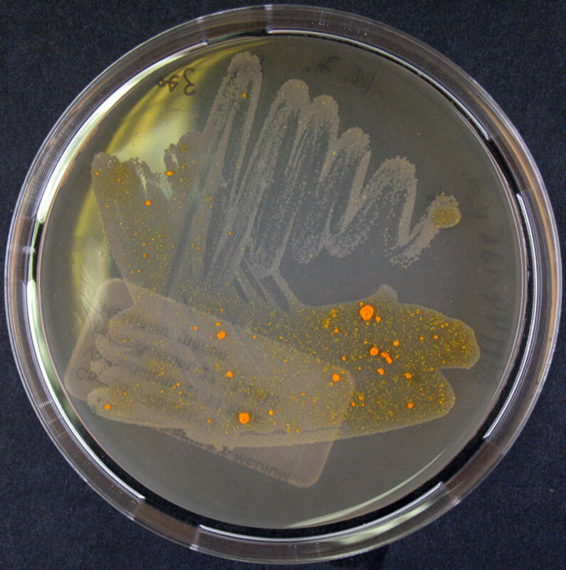 Амикацин безопасен и улучшает респираторные симптомы при легочных заболеваниях, вызванных M. avium complex