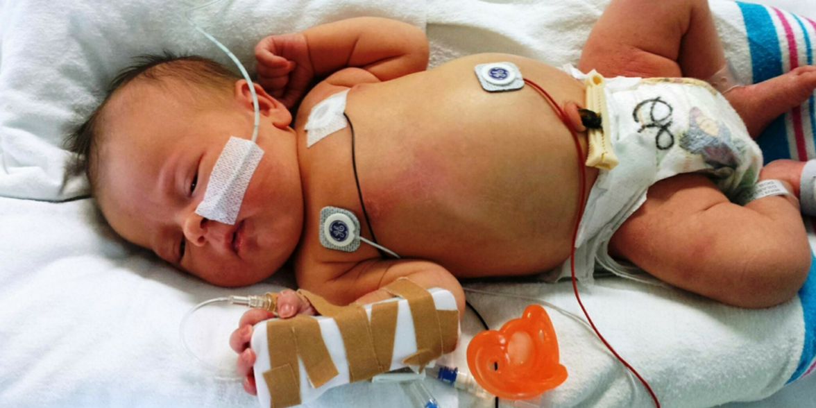 Антимикробное управление в неонатальных отделениях реанимации и интенсивной терапии