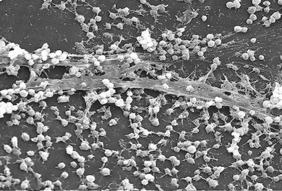 Недавно обнаруженный у бактерий регуляторный механизм имеет значение для разработки антибактериальных средств