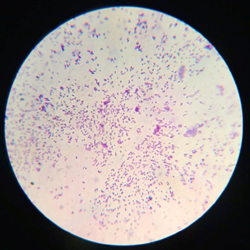 Ученые Пермского Политеха разработали биосорбент для очистки вод на основе активированного угля и микроорганизмов