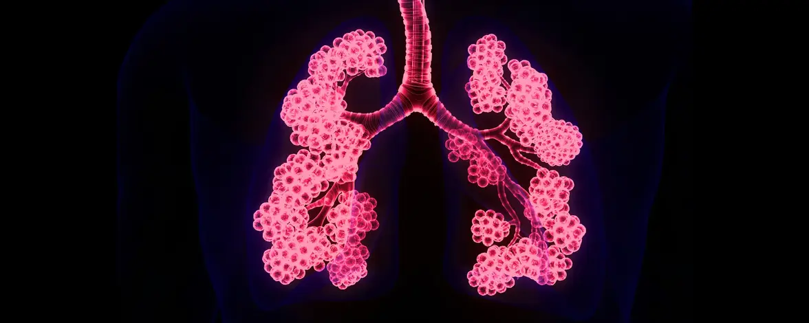 Система редактирования генов исправляет мутацию при муковисцидозе