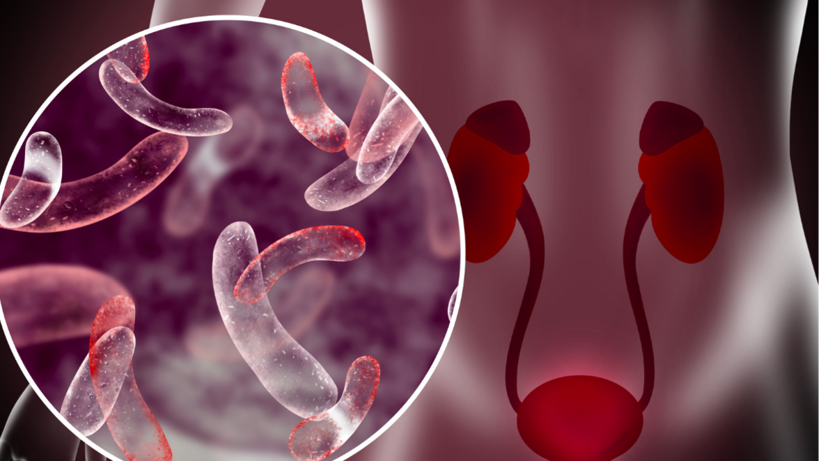 Характеристика педиатрического микробиома мочи с разрешением на уровне видов