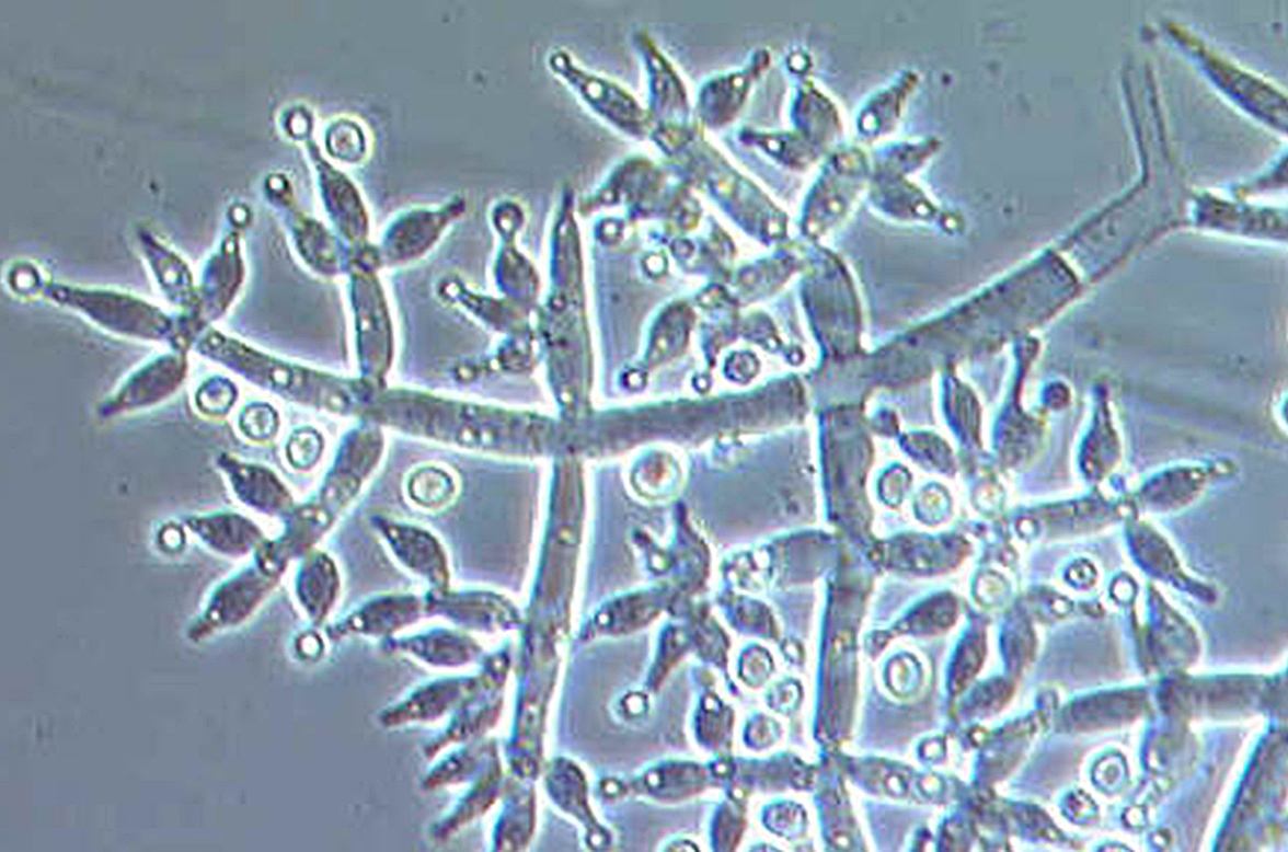 Этот грибок растет энергичнее, когда чувствует хорошие вибрации