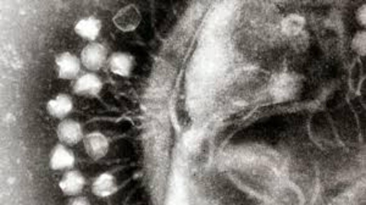 ИИ сканирует «темную материю» РНК и обнаруживает 70 000 новых вирусов