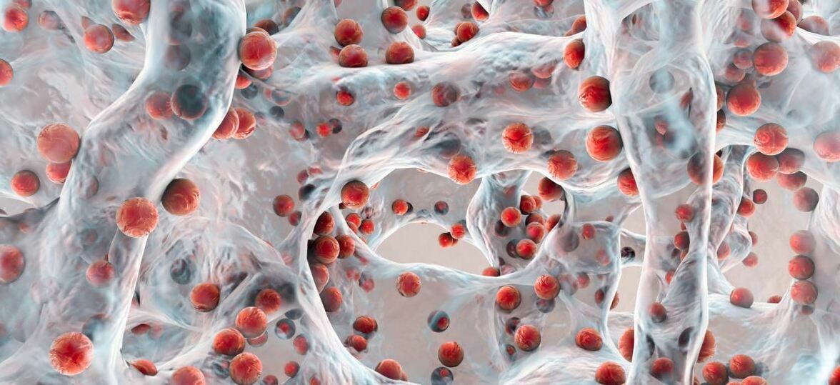 Рифабутин: антибиотик с высоким потенциалом против планктонных и биопленочных стафилококковых клинических изолятов