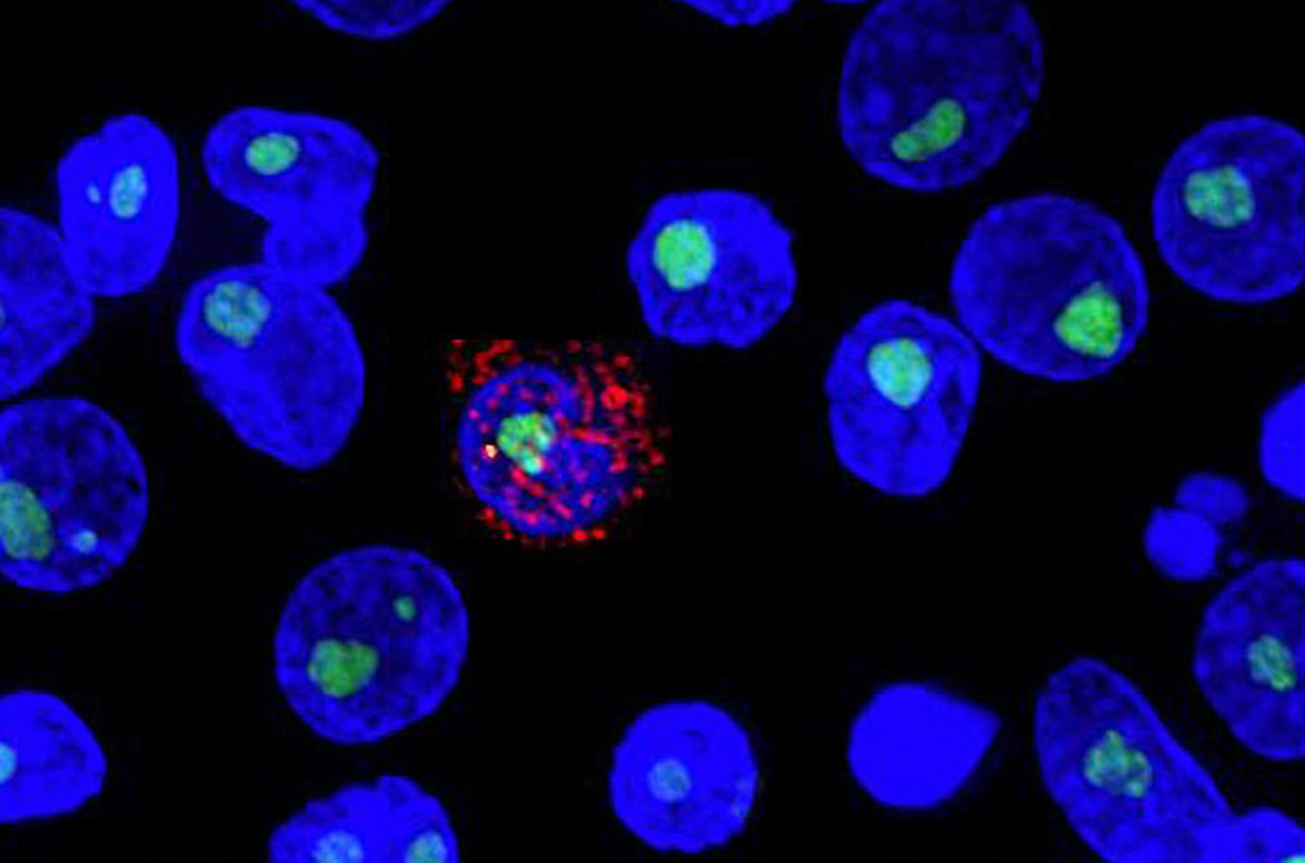 Новые исследования антител укрепляют надежду на излечение от ВИЧ