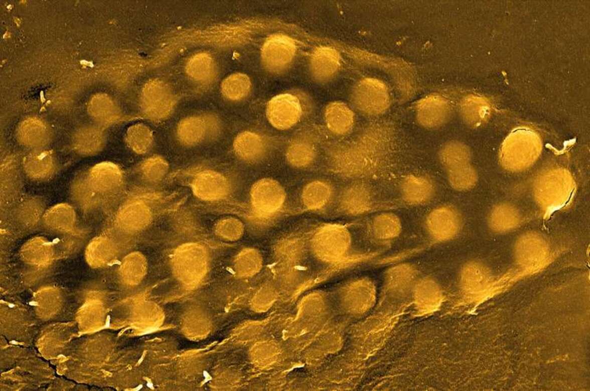 Обнаружен новый ингибитор стафилококкового токсина