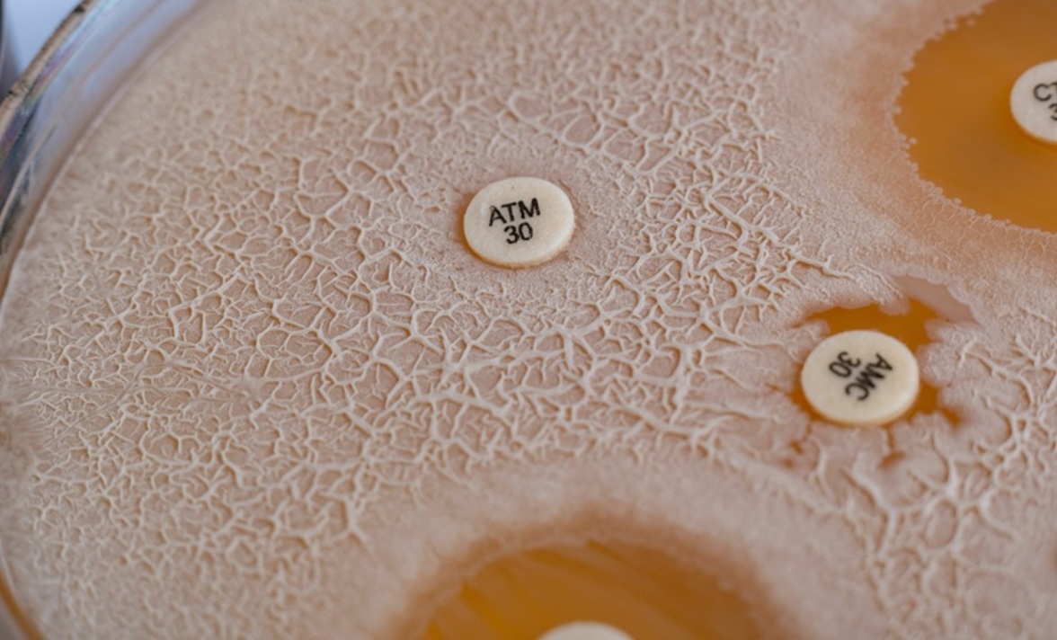 В 2022 году от осложнений, вызванных AMR, умерло 3 миллиона детей