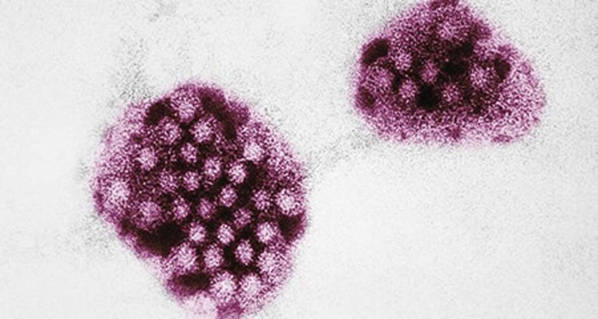 Интересные микробиологические случаи: диарея у пациентки с почечным трансплантантом