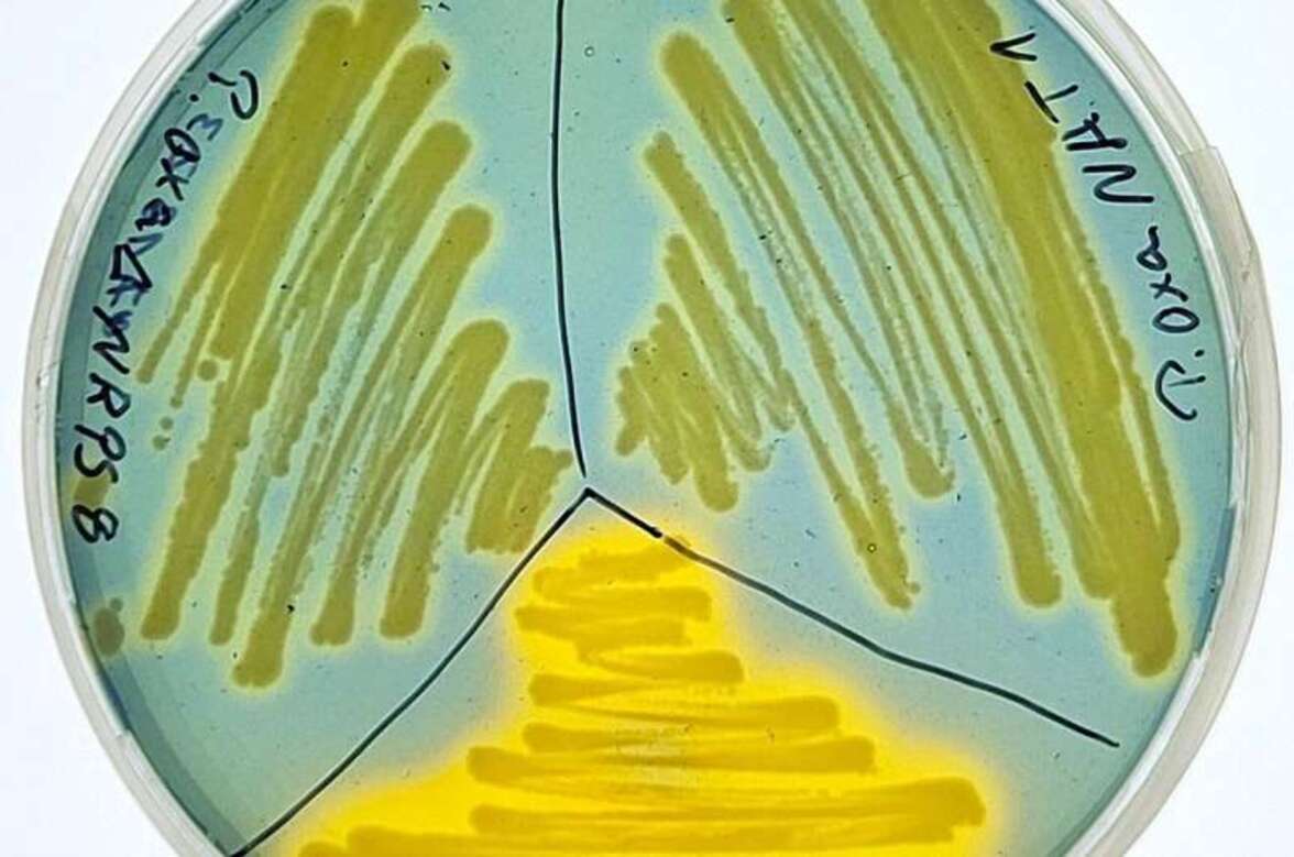 Бактерии Pandoraea выделяют уникальные молекулы, нарушающие баланс микробиома легких