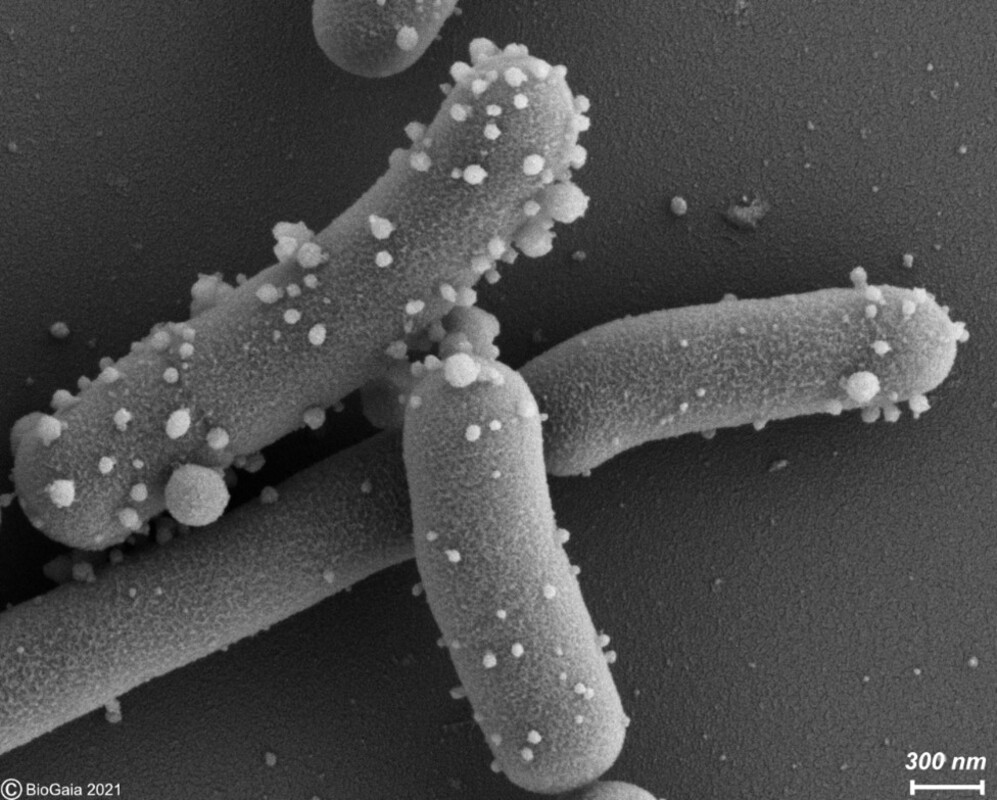 Обнаружена новая причина хронического воспаления при язвенном колите