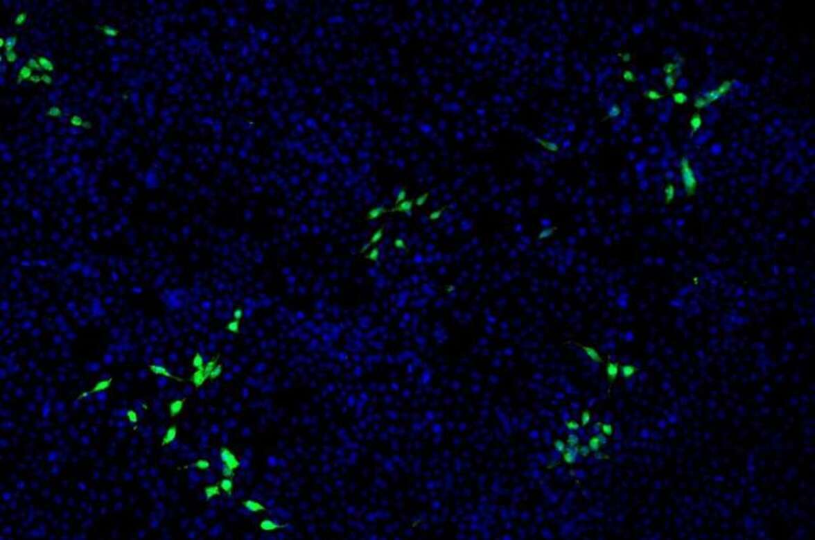 Вирус гепатита E может инфицировать клетки почек и размножаться в них