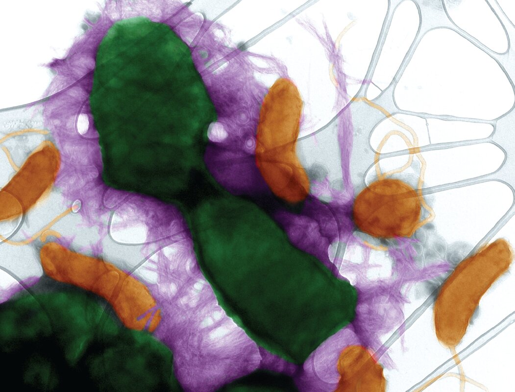 Как бактерии используют белок, ассоциированный с болезнью Альцгеймера