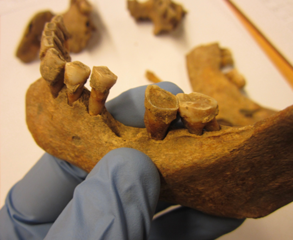 Древний зубной налет раскрывает образ жизни доисторических людей