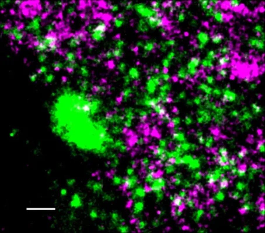 Вирус герпеса захватывает фермент хозяина. Блокирование этого фермента может предотвратить появление герпеса.