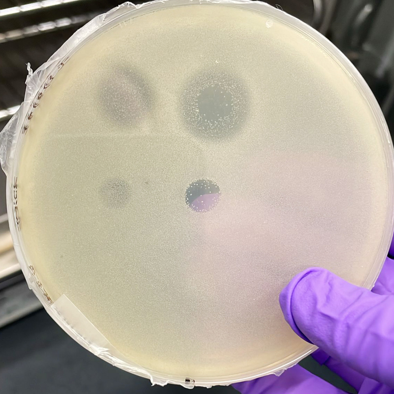 Живучие микробы, обитающие в горячих источниках, являются новым источником антибиотиков