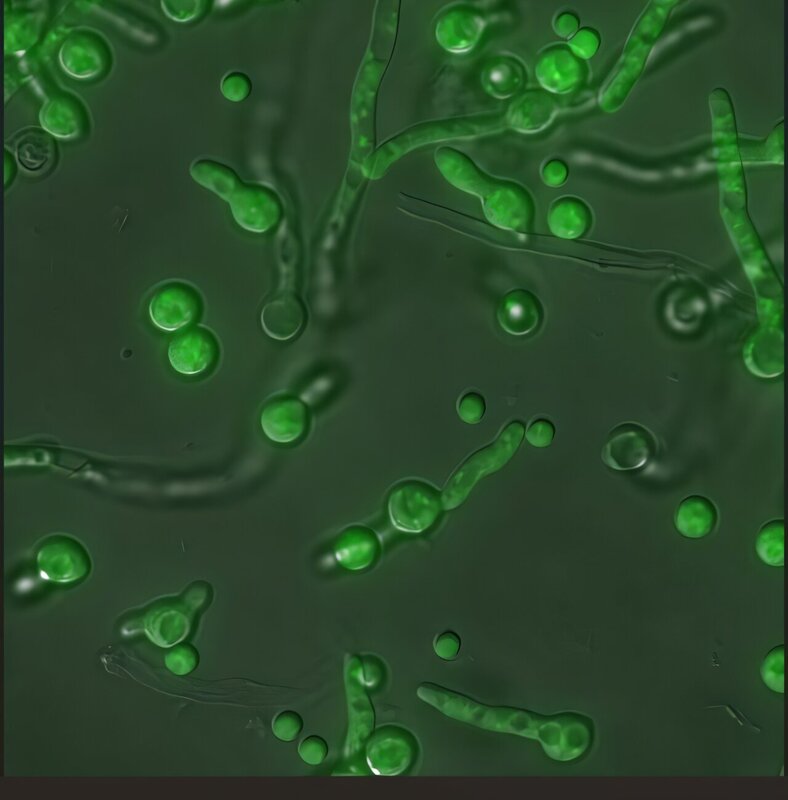 Вирусы, скрытые в грибках, могут быть причиной смертельных легочных инфекций