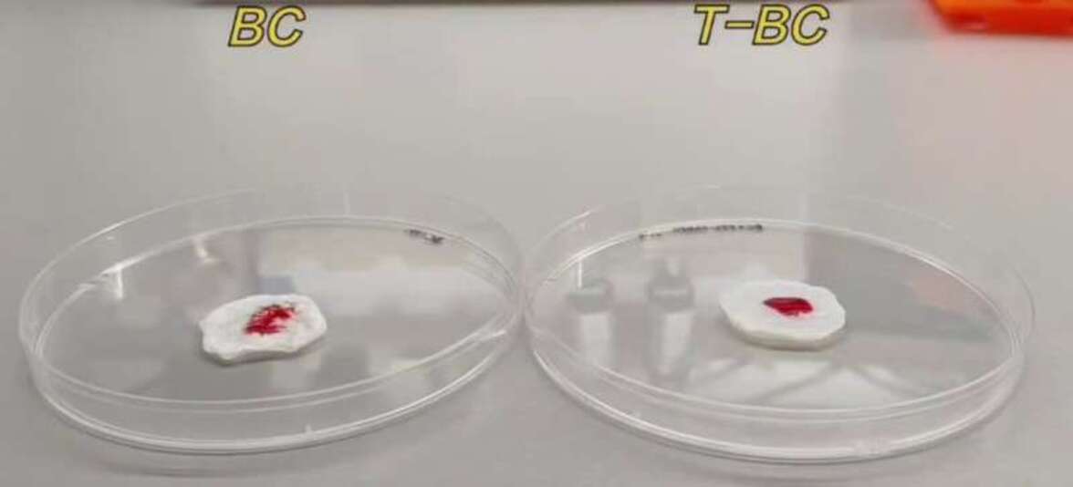 Повязка на основе бактериальной целлюлозы обеспечивает быстрый контроль кровотечения при лечении ожоговых ран
